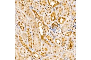Immunohistochemistry (IHC) image for anti-G Protein Pathway Suppressor 1 (GPS1) (AA 258-527) antibody (ABIN6141361)