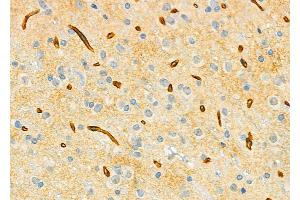 ABIN6265933 and ABIN6279507 at 1/100 staining Rat brain tissue by IHC-P. (USP54 Antikörper  (Internal Region))