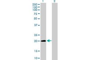 Western Blot analysis of SNX24 expression in transfected 293T cell line by SNX24 MaxPab polyclonal antibody. (SNX24 Antikörper  (AA 1-169))