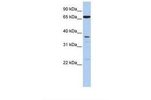 Image no. 1 for anti-ATP-Binding Cassette, Sub-Family B (MDR/TAP), Member 9 (ABCB9) (N-Term) antibody (ABIN6738091)