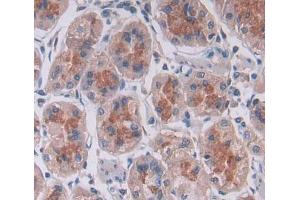 Used in DAB staining on fromalin fixed paraffin- embedded stomach tissue (PTPN22 Antikörper  (AA 1-233))