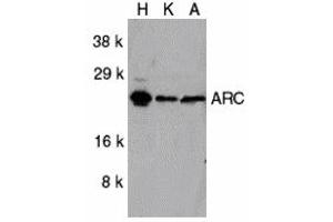 Western Blotting (WB) image for anti-ARC (C-Term) antibody (ABIN1030252) (ARC (C-Term) Antikörper)