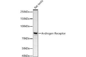 Western blot analysis of extracts of Rat testis, using Androgen Receptor antibody (ABIN3022797, ABIN3022798, ABIN3022799 and ABIN6219233) at 1:668 dilution. (Androgen Receptor Antikörper)
