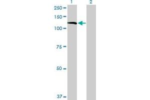 INPP5F Antikörper  (AA 1-1132)