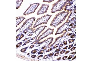IHC analysis of AMFR using anti-AMFR antibody (ABIN4886455). (AMFR Antikörper  (AA 553-643))