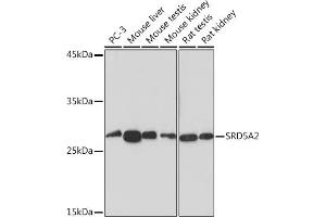 Western blot analysis of extracts of various cell lines, using SRD5 Rabbit mAb (ABIN7270595) at 1:1000 dilution. (SRD5A2 Antikörper)