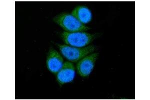 IF analysis of SBCAD/ACADSB using anti-SBCAD/ACADSB antibody (ABIN7602837).