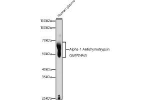 Western blot analysis of extracts of Human plasma, using Alpha-1 Antichymotrypsin (SERPIN) antibody (ABIN3016733, ABIN3016734, ABIN3016735 and ABIN6219829) at 1:1000 dilution. (SERPINA3 Antikörper  (AA 24-423))