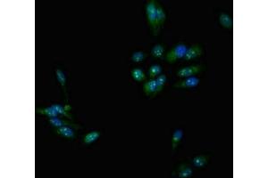 Immunofluorescent analysis of Hela cells using ABIN7159195 at dilution of 1:100 and Alexa Fluor 488-congugated AffiniPure Goat Anti-Rabbit IgG(H+L) (DMC1 Antikörper  (AA 5-153))
