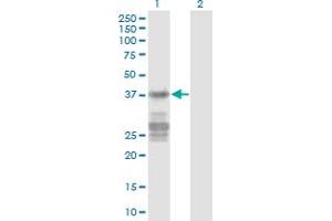 Western Blot analysis of CNN3 expression in transfected 293T cell line by CNN3 monoclonal antibody (M03), clone 2C7. (CNN3 Antikörper  (AA 1-329))