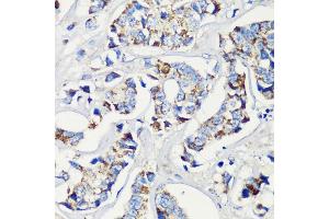 Immunohistochemistry (IHC) image for anti-Myeloid/lymphoid Or Mixed-Lineage Leukemia 5 (Trithorax Homolog) (MLL5) (AA 200-500) antibody (ABIN6142983)