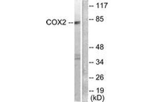Western blot analysis of extracts from A549 cells, using Cox2 Antibody. (COX2 Antikörper  (AA 555-604))