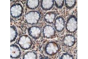 Figure. (LPCAT3 Antikörper  (AA 122-233))