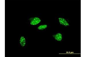 Immunofluorescence of monoclonal antibody to UBR2 on HeLa cell.