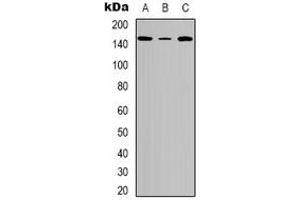 Western blot analysis of Tensin 2 (pY483) expression in A549 (A), Hela (B), NIH3T3 (C) whole cell lysates.