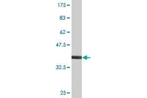 Western Blot detection against Immunogen (36. (PIK3R4 Antikörper  (AA 1259-1358))