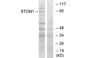 Western Blotting (WB) image for anti-Stonin 1 (STON1) (C-Term) antibody (ABIN1850138) (STON1 Antikörper  (C-Term))
