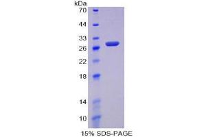 SDS-PAGE (SDS) image for Signal-Regulatory Protein alpha (SIRPA) (AA 105-324) protein (His tag) (ABIN2126749)