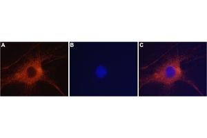 Expression of GluR6 in rat DRG neurons - Immunocytochemistry of rat dorsal root ganglion (DRG) neurons. (GRIK2 Antikörper  (Intracellular))
