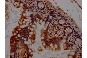 IHC image of ABIN7127424 diluted at 1:100 and staining in paraffin-embedded human small intestine tissue performed on a Leica BondTM system.