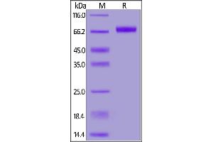 Human CD39, His Tag on  under reducing (R) condition.