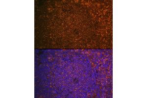 Immunofluorescence analysis of Mouse spleen using CST7 antibody (ABIN6131040, ABIN6139156, ABIN6139157 and ABIN6224188) at dilution of 1:100. (CST7 Antikörper  (AA 20-145))