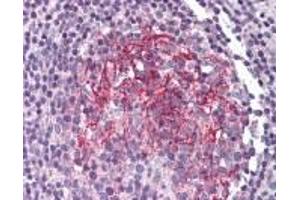 Immunohistochemistry (IHC) image for anti-Interleukin 1 Receptor, Type II (IL1R2) (AA 289-300) antibody (ABIN2470239)