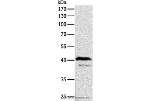 Western blot analysis of Mouse brain tissue, using ADAP1 Polyclonal Antibody at dilution of 1:500 (ADAP1 Antikörper)