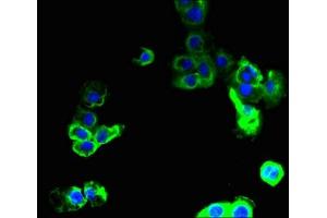 Immunofluorescent analysis of A431 cells using ABIN7166580 at dilution of 1:100 and Alexa Fluor 488-congugated AffiniPure Goat Anti-Rabbit IgG(H+L) (SLC36A2 Antikörper  (AA 1-58))