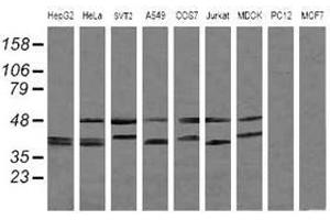 Image no. 2 for anti-Mitogen-Activated Protein Kinase Kinase 3 (MAP2K3) antibody (ABIN1499419) (MAP2K3 Antikörper)