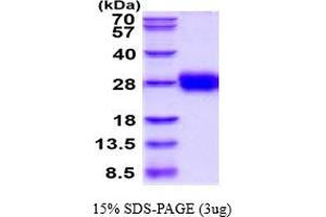 TFPI2 Protein (AA 23-213) (His tag)