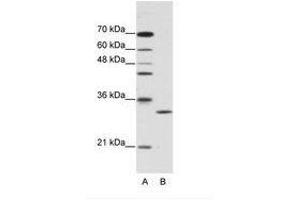 Image no. 1 for anti-Chloride Intracellular Channel 1 (CLIC1) (C-Term) antibody (ABIN202111)