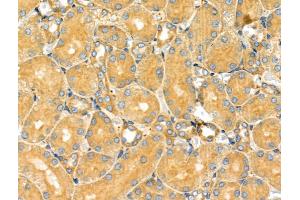 ABIN6263217 and ABIN6266832 at 1/100 staining Rat kidney tissue by IHC-P. (MAP4K4 Antikörper  (Internal Region))