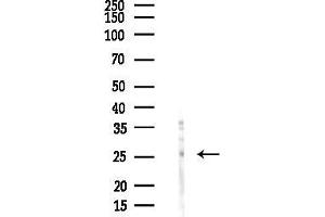 anti-Adenylate Kinase 2 (AK2) (Internal Region) antibody