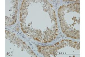 Image no. 7 for anti-ArsA Arsenite Transporter, ATP-Binding, Homolog 1 (ASNA1) (AA 239-349) antibody (ABIN598547) (ASNA1 Antikörper  (AA 239-349))