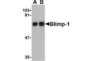 Western Blotting (WB) image for anti-PR Domain Containing 1, with ZNF Domain (PRDM1) (C-Term) antibody (ABIN1030298) (PRDM1 Antikörper  (C-Term))