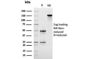 SDS-PAGE Analysis Purified Monospecific Mouse Monoclonal Antibody to LSP1 (LSP1/3042). (LSP1 Antikörper  (AA 174-278))