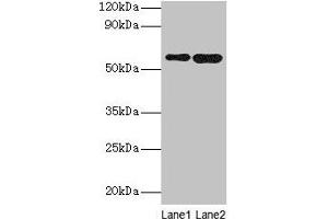 Western blot All lanes: SCP2 antibody at 2 μg/mL Lane 1: A549 whole cell lysate Lane 2: MCF-7 whole cell lysate Secondary Goat polyclonal to rabbit IgG at 1/10000 dilution Predicted band size: 59, 16, 35, 51, 7, 55, 57 kDa Observed band size: 59 kDa (SCP2 Antikörper  (AA 1-143))
