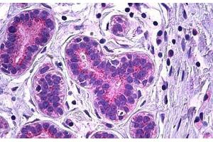 Human Breast, Epithelium: Formalin-Fixed, Paraffin-Embedded (FFPE)