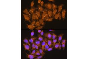 Immunofluorescence analysis of HeLa cells using V1E1 Rabbit pAb (ABIN1678795, ABIN3018056, ABIN3018057 and ABIN6220346) at dilution of 1:100.