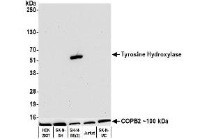 Western Blotting (WB) image for anti-Tyrosine Hydroxylase (TH) (AA 450-500) antibody (ABIN7449433) (Rekombinanter Tyrosine Hydroxylase Antikörper  (AA 450-500))