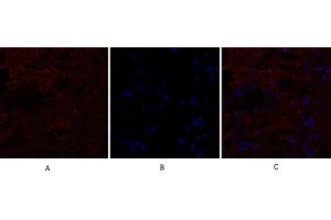 Immunofluorescence analysis of human breast cancer tissue. (IL-8 Antikörper  (C-Term))