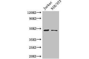 Western Blot Positive WB detected in: Jurkat whole cell lysate, NIH/3T3 whole cell lysate All lanes: SGK1 antibody at 3 μg/mL Secondary Goat polyclonal to rabbit IgG at 1/50000 dilution Predicted band size: 49, 60, 51, 48, 53 kDa Observed band size: 49 kDa (SGK1 Antikörper  (AA 247-406))
