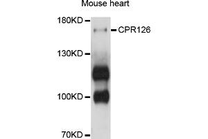 Western blot analysis of extracts of mouse heart, using GPR126 antibody (ABIN4903810) at 1:1000 dilution.