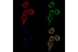 ABIN6265008 and ABIN6276582 staining HepG2 cells by IF/ICC.