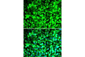 Immunofluorescence analysis of U2OS cells using EIF5 antibody (ABIN5973954). (EIF5 Antikörper)