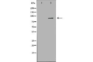 Western blot analysis of K562 whole cell lysates, using ARHGEF7 Antibody. (ARHGEF7 Antikörper  (Internal Region))