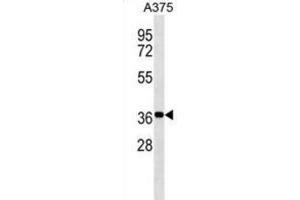 Western Blotting (WB) image for anti-Non-SMC Element 1 Homolog (NSMCE1) antibody (ABIN3000163) (NSMCE1 Antikörper)