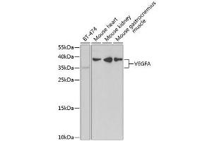 Western Blot Analysis using ABIN6150086 (VEGFA Antikörper  (AA 1-147))
