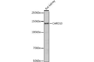 Western blot analysis of extracts of Rat kidney, using C antibody (ABIN6127549, ABIN6137937, ABIN6137938 and ABIN6223226) at 1:500 dilution. (CARD10 Antikörper  (AA 863-1032))